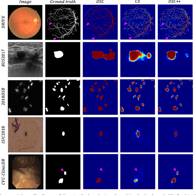 Figure 3 for Calibrating the Dice loss to handle neural network overconfidence for biomedical image segmentation