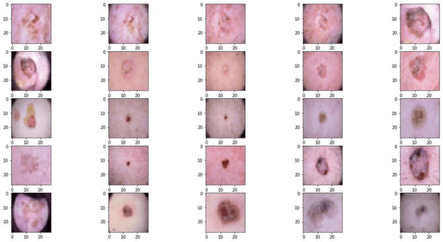 Figure 1 for Dermatologist vs Neural Network