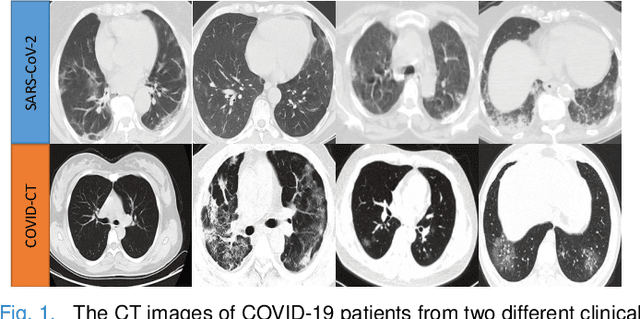 Figure 1 for Contrastive Cross-site Learning with Redesigned Net for COVID-19 CT Classification