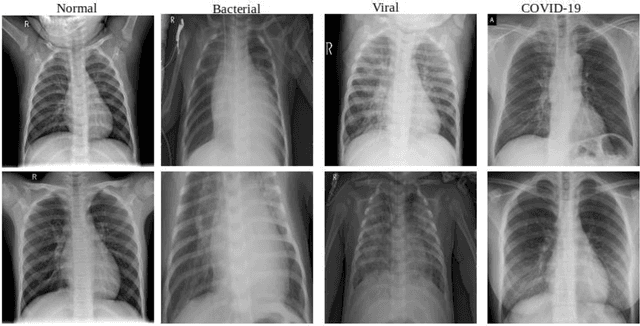 Figure 1 for COVID-ResNet: A Deep Learning Framework for Screening of COVID19 from Radiographs