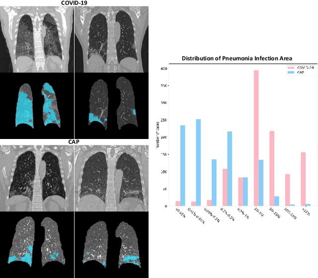 Figure 1 for Dual-Sampling Attention Network for Diagnosis of COVID-19 from Community Acquired Pneumonia