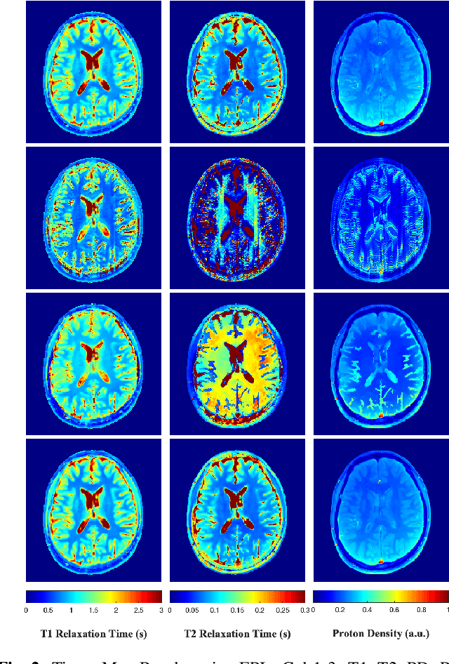 Figure 4 for A Plug-and-Play Approach to Multiparametric Quantitative MRI: Image Reconstruction using Pre-Trained Deep Denoisers