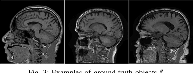 Figure 3 for Learning stochastic object models from medical imaging measurements by use of advanced AmbientGANs