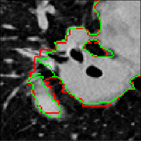 Figure 4 for Using the Order of Tomographic Slices as a Prior for Neural Networks Pre-Training