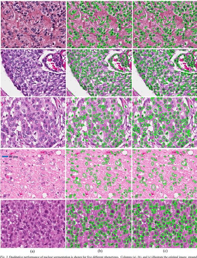 Figure 3 for Deep Learning Models Delineates Multiple Nuclear Phenotypes in H&E Stained Histology Sections