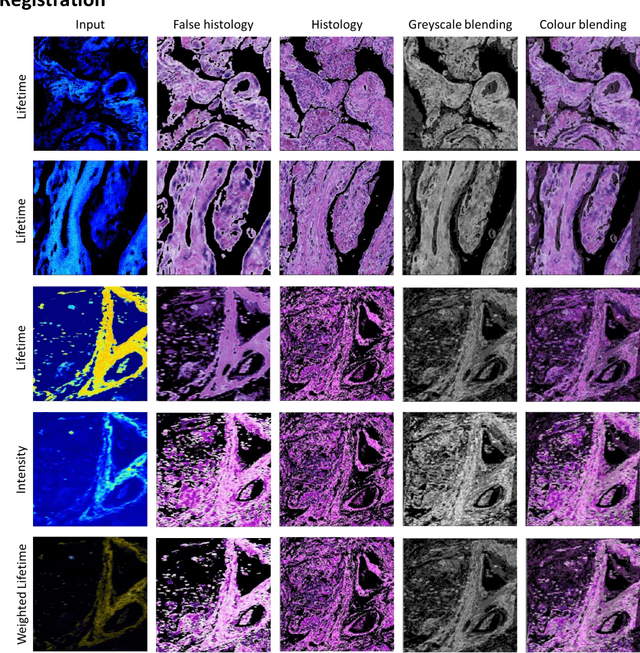 Figure 3 for Deep Learning-Assisted Co-registration of Full-Spectral Autofluorescence Lifetime Microscopic Images with H&E-Stained Histology Images