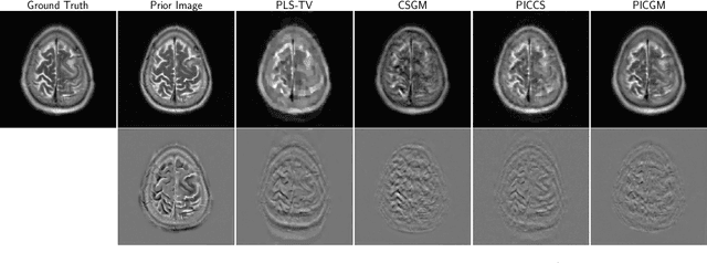 Figure 3 for Prior Image-Constrained Reconstruction using Style-Based Generative Models