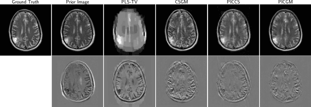 Figure 4 for Prior Image-Constrained Reconstruction using Style-Based Generative Models