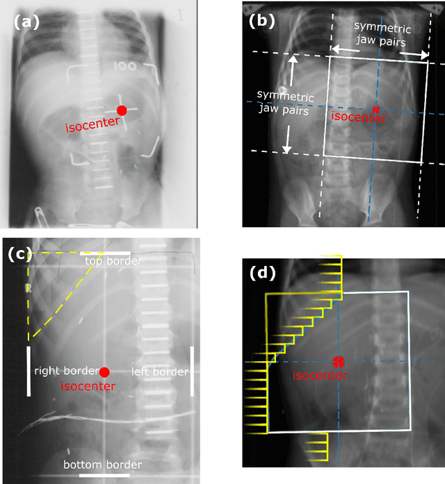 Figure 1 for Surrogate-free machine learning-based organ dose reconstruction for pediatric abdominal radiotherapy