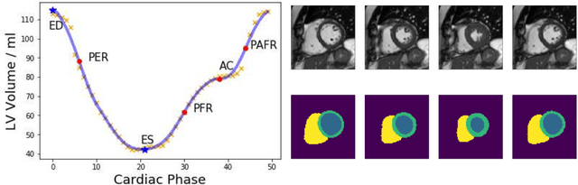 Figure 3 for Global and Local Interpretability for Cardiac MRI Classification