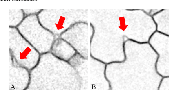 Figure 1 for Accurate 3D Cell Segmentation using Deep Feature and CRF Refinement