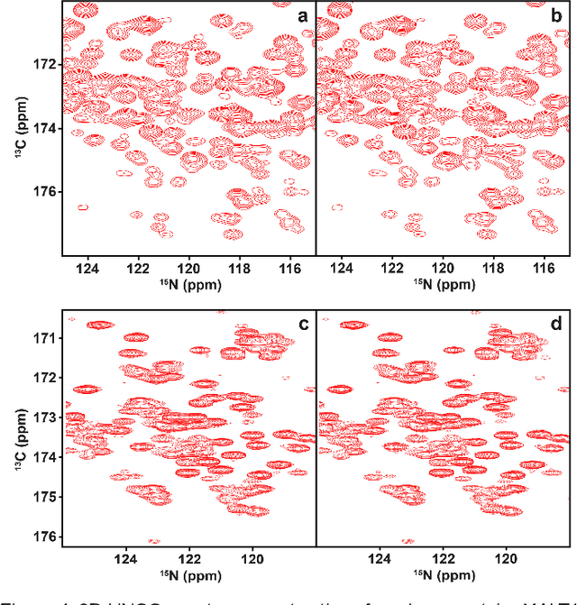 Figure 4 for Accelerated Nuclear Magnetic Resonance Spectroscopy with Deep Learning