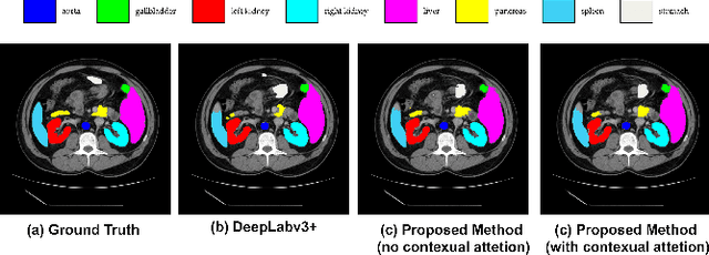 Figure 3 for TransDeepLab: Convolution-Free Transformer-based DeepLab v3+ for Medical Image Segmentation