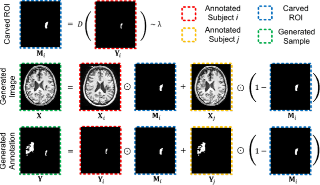 Figure 1 for CarveMix: A Simple Data Augmentation Method for Brain Lesion Segmentation