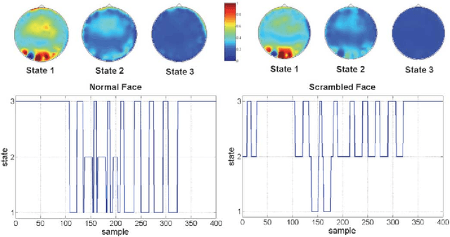 Figure 2 for Prediction of Synchrostate Transitions in EEG Signals Using Markov Chain Models