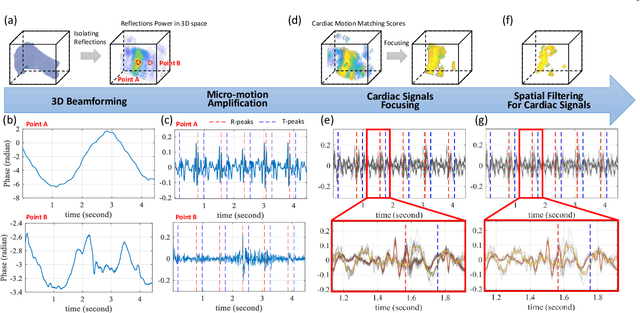 Figure 4 for Contactless Electrocardiogram Monitoring with Millimeter Wave Radar