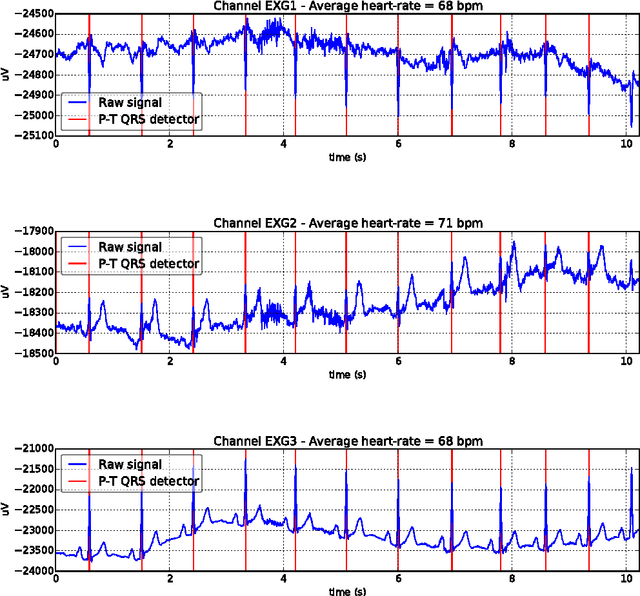 Figure 1 for A Reproducible Study on Remote Heart Rate Measurement