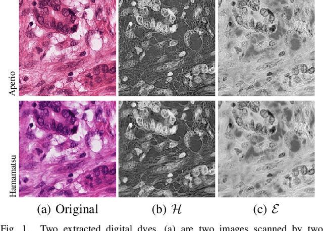 Figure 1 for RestainNet: a self-supervised digital re-stainer for stain normalization