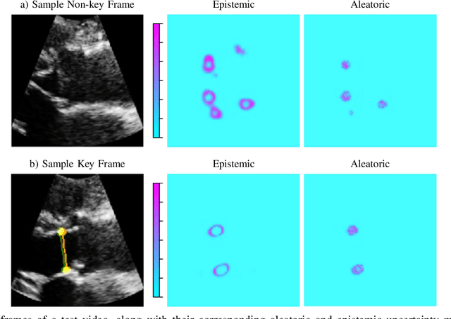 Figure 3 for U-LanD: Uncertainty-Driven Video Landmark Detection