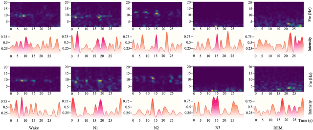 Figure 4 for Multi-Tier Platform for Cognizing Massive Electroencephalogram