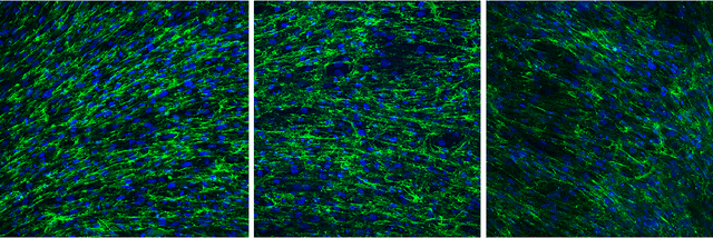 Figure 1 for A Convolutional Neural Network for the Automatic Diagnosis of Collagen VI related Muscular Dystrophies