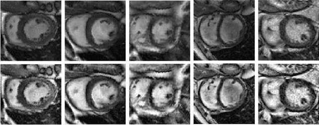 Figure 4 for Spatio-temporal Multi-task Learning for Cardiac MRI Left Ventricle Quantification