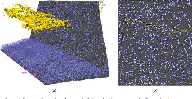 Figure 4 for A modular U-Net for automated segmentation of X-ray tomography images in composite materials