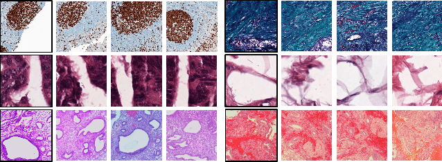 Figure 3 for Gram Barcodes for Histopathology Tissue Texture Retrieval
