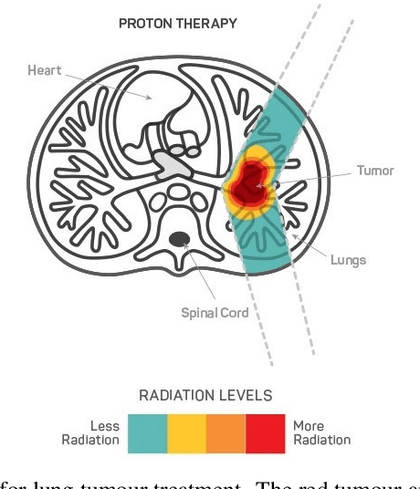 Figure 1 for AWEU-Net: An Attention-Aware Weight Excitation U-Net for Lung Nodule Segmentation