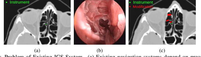 Figure 1 for Real-time Virtual Intraoperative CT for Image Guided Surgery
