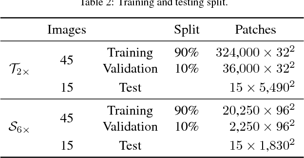 Figure 4 for Super-resolution of Sentinel-2 images: Learning a globally applicable deep neural network