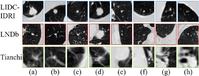 Figure 1 for MVCNet: Multiview Contrastive Network for Unsupervised Representation Learning for 3D CT Lesions