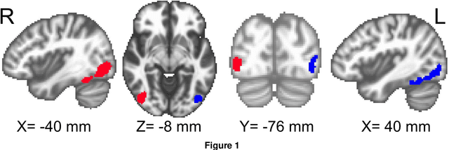 Figure 1 for A Test for Shared Patterns in Cross-modal Brain Activation Analysis
