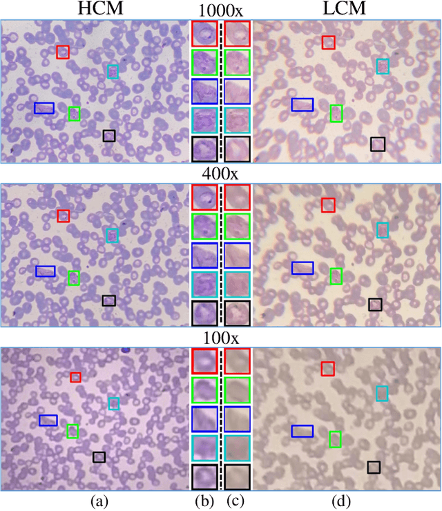 Figure 1 for Towards Low-Cost and Efficient Malaria Detection