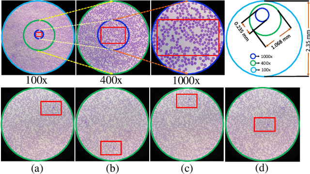 Figure 3 for Towards Low-Cost and Efficient Malaria Detection