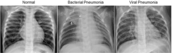 Figure 1 for Privacy-preserving Machine Learning for Medical Image Classification