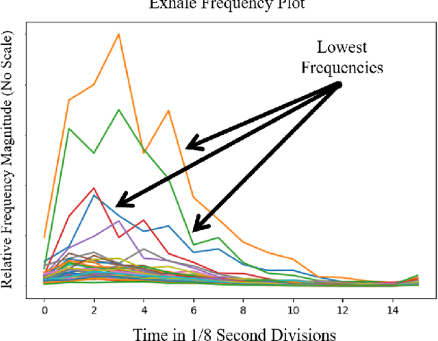 Figure 3 for Application of Autoencoder-Assisted Recurrent Neural Networks to Prevent Cases of Sudden Infant Death Syndrome