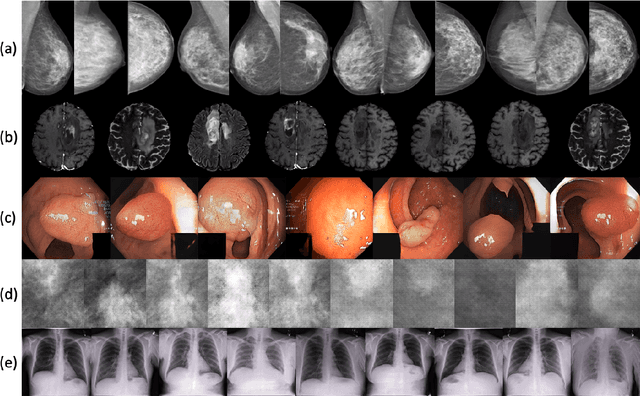 Figure 1 for medigan: A Python Library of Pretrained Generative Models for Enriched Data Access in Medical Imaging