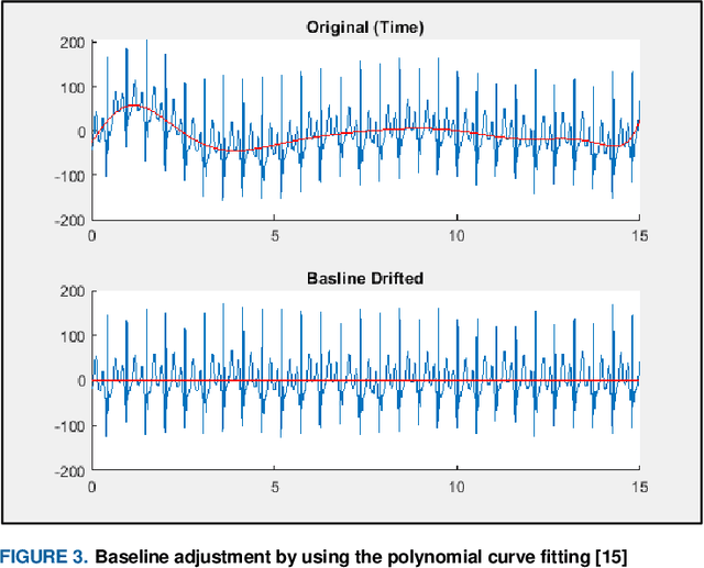 Figure 3 for A Machine Learning Framework for Biometric Authentication using Electrocardiogram