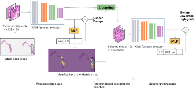 Figure 1 for An attention-based multi-resolution model for prostate whole slide imageclassification and localization