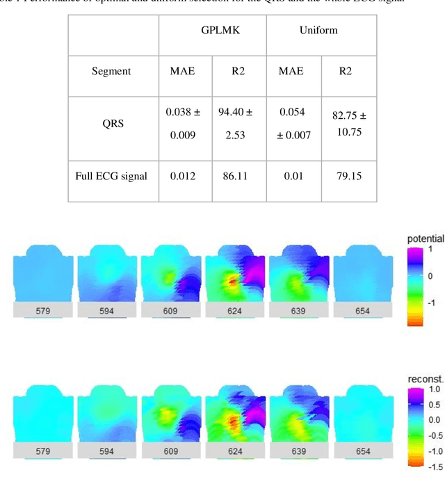 Figure 2 for Optimal Sensor Placement in Body Surface Networks using Gaussian Processes