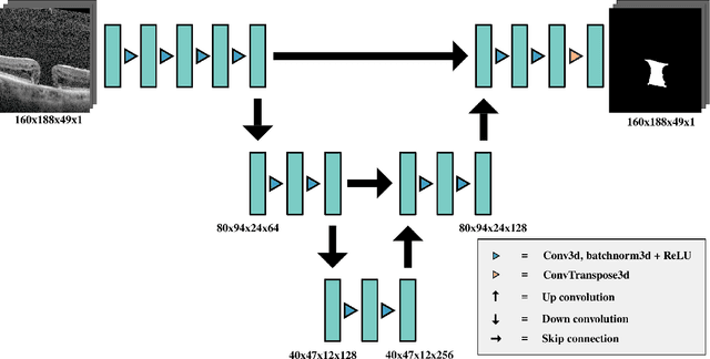 Figure 1 for Robust 3D U-Net Segmentation of Macular Holes