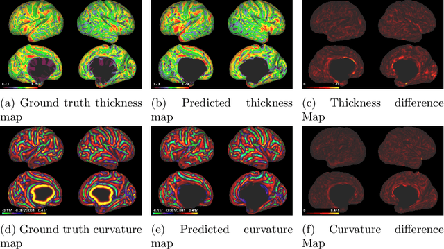 Figure 3 for Surface Agnostic Metrics for Cortical Volume Segmentation and Regression
