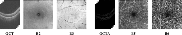 Figure 3 for Differentiable Projection from Optical Coherence Tomography B-Scan without Retinal Layer Segmentation Supervision
