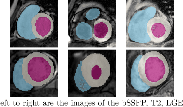 Figure 3 for Adversarial Convolutional Networks with Weak Domain-Transfer for Multi-Sequence Cardiac MR Images Segmentation