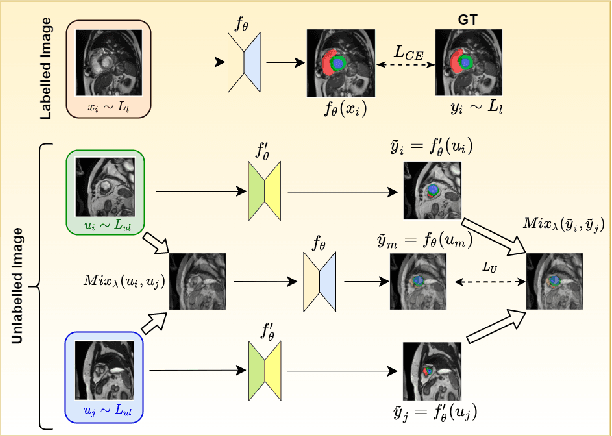 Figure 1 for An Embarrassingly Simple Consistency Regularization Method for Semi-Supervised Medical Image Segmentation