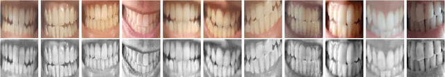 Figure 3 for DeepTeeth: A Teeth-photo Based Human Authentication System for Mobile and Hand-held Devices