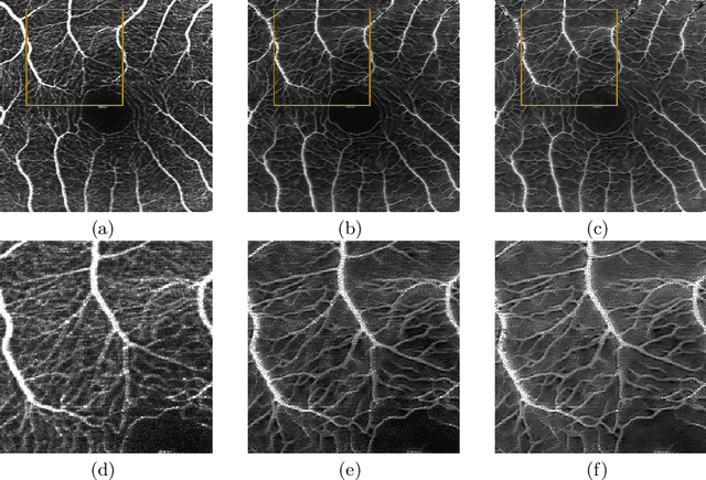 Figure 4 for Lesson Learnt: Modularization of Deep Networks Allow Cross-Modality Reuse