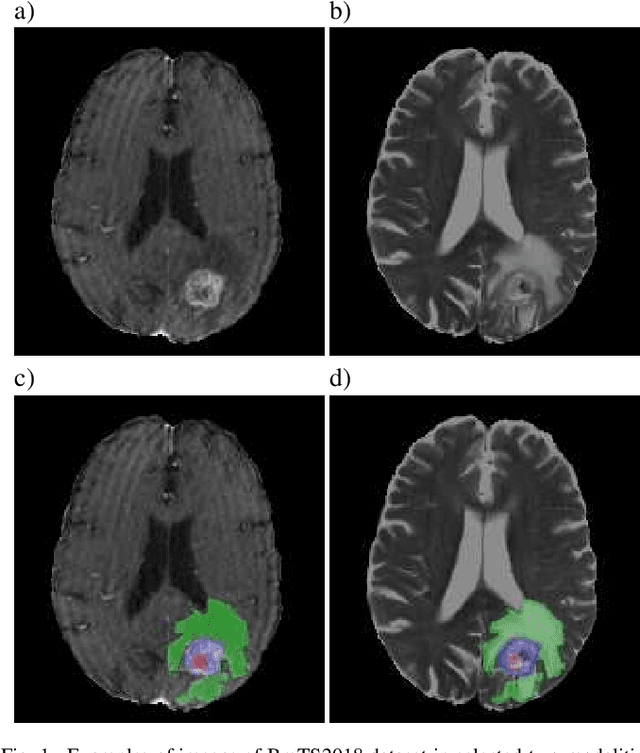 Figure 1 for Quantitative Impact of Label Noise on the Quality of Segmentation of Brain Tumors on MRI scans