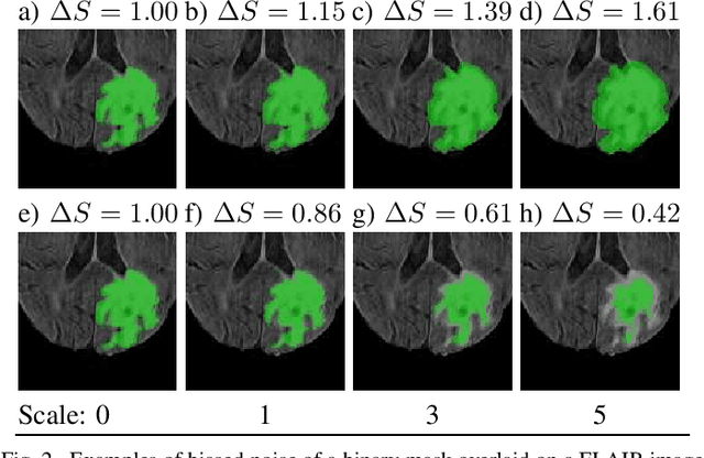 Figure 2 for Quantitative Impact of Label Noise on the Quality of Segmentation of Brain Tumors on MRI scans